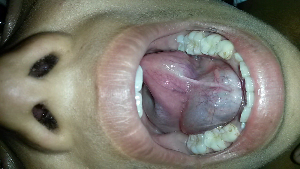 Pediatric General Surgery Image 1